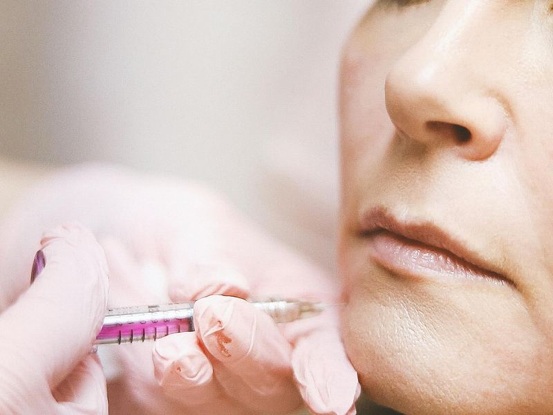 Harmonização Orofacial